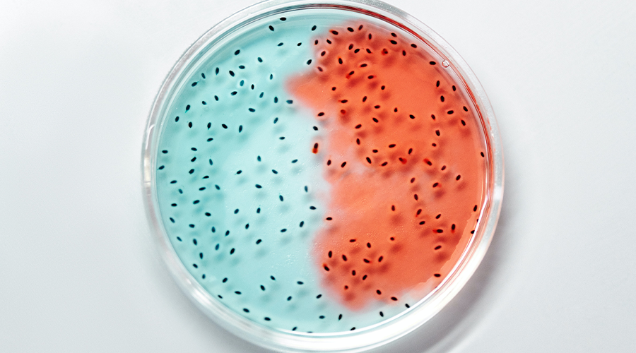 3 Weird Bacteria Facts