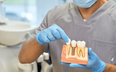 Dental Implants: Are They Right For You?
