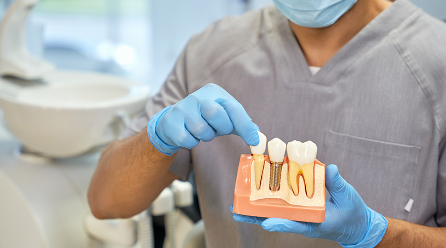 Dental Implants: Are They Right For You?