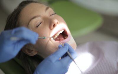 Understanding Dental Crowns And If You Might Need One