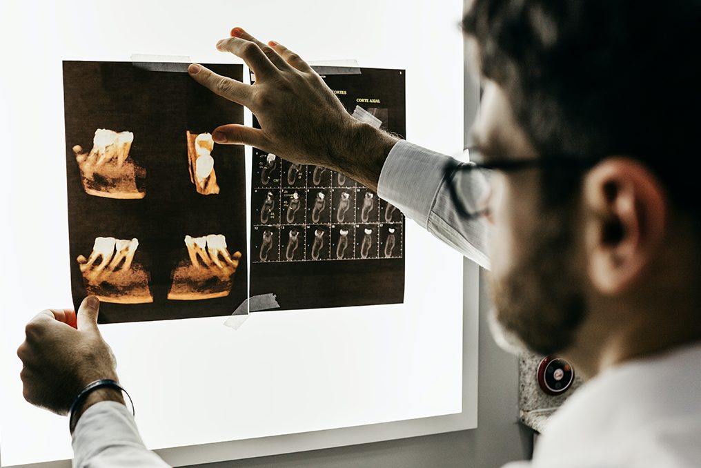 Everything You Need To Know About Root Canals, image of a dentist looking at dental x-rays