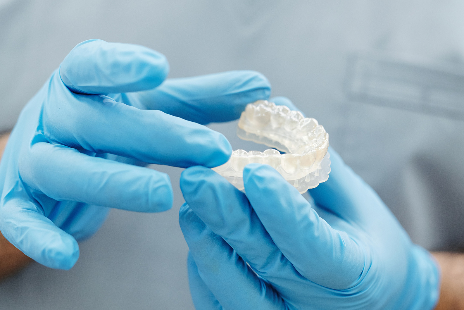 Keeping Your Teeth White After Bleaching Oasis Dental Arts