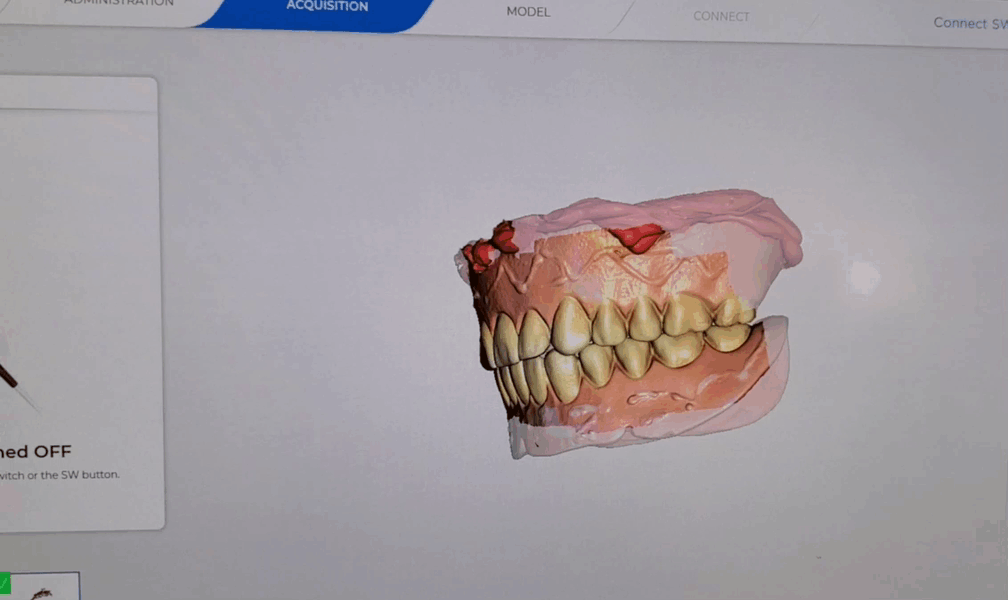 2 visit Dentures, image of  the denture technology at Oasis Dental Arts