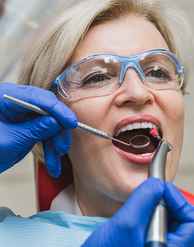 Dental Fillings, image of a older woman getting fillings done at the dentist in Mira Mesa