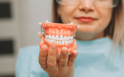 5 Reasons To Upgrade Dentures to Dental Implants